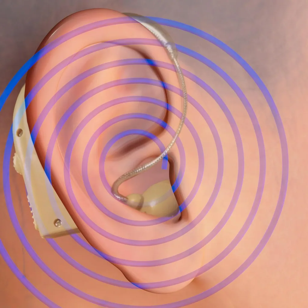 Hearing amplifier "Sound Genie", 2 pieces